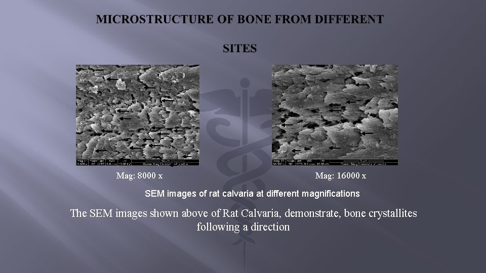 Mag: 8000 x Mag: 16000 x SEM images of rat calvaria at different magnifications