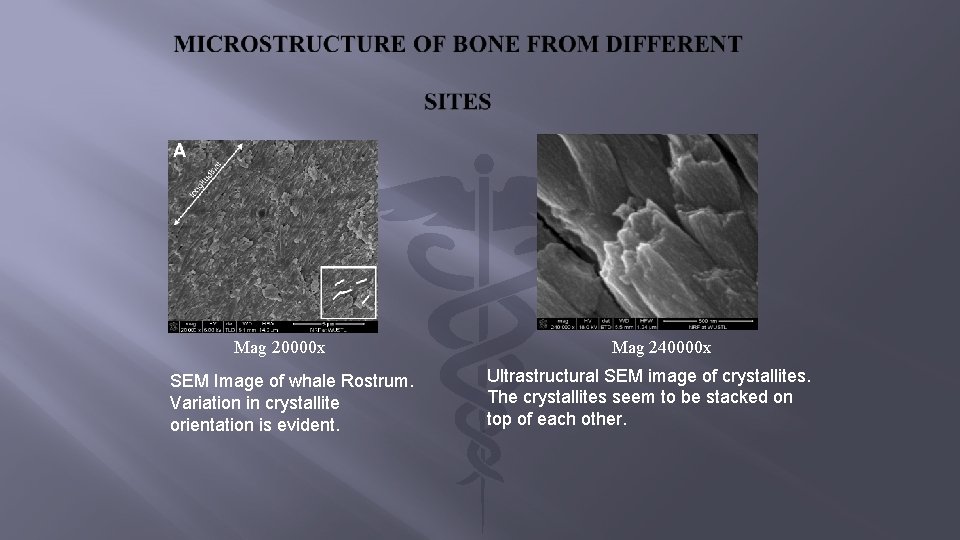 Mag 20000 x SEM Image of whale Rostrum. Variation in crystallite orientation is evident.