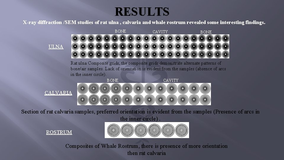 RESULTS X-ray diffraction /SEM studies of rat ulna , calvaria and whale rostrum revealed