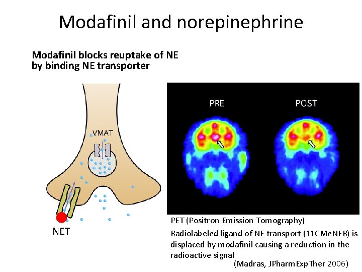 Modafinil and norepinephrine Modafinil blocks reuptake of NE by binding NE transporter NET PET