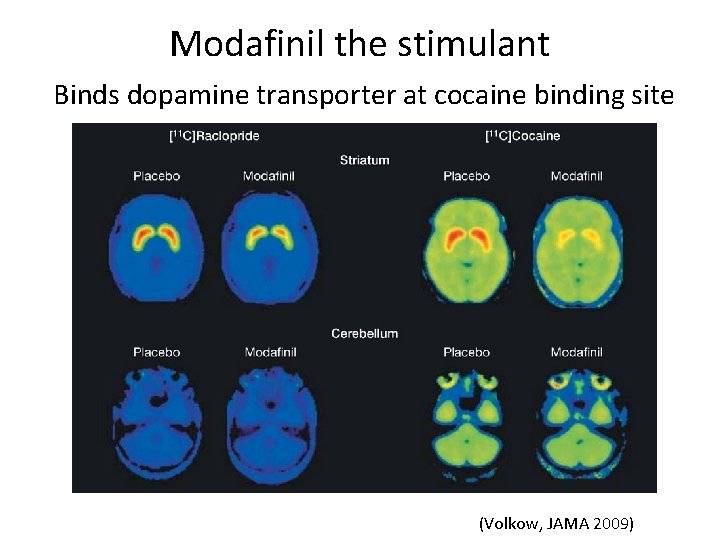 Modafinil the stimulant Binds dopamine transporter at cocaine binding site (Volkow, JAMA 2009) 