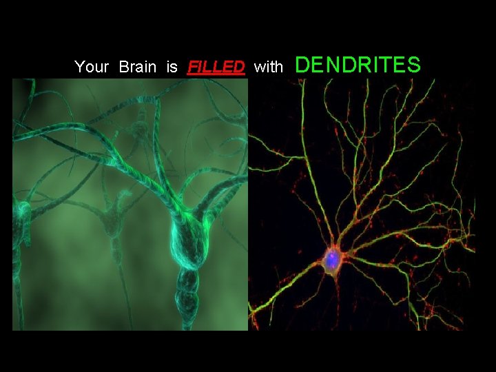 Your Brain is FILLED with DENDRITES 