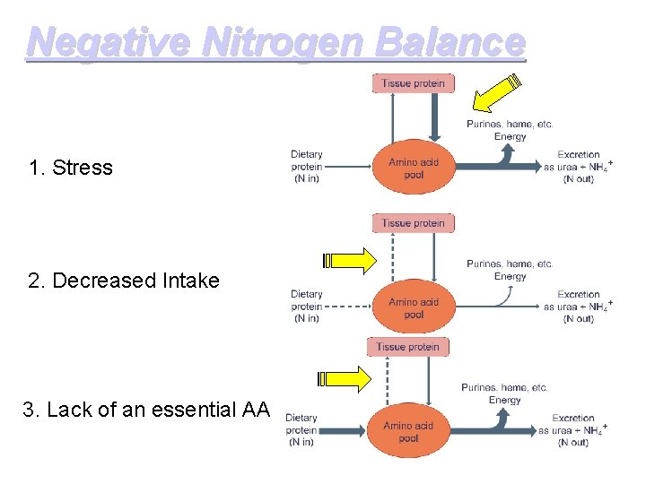 Negative Nitrogen Balance 1. Stress 2. Decreased Intake 3. Lack of an essential AA