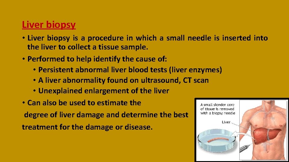 Liver biopsy • Liver biopsy is a procedure in which a small needle is