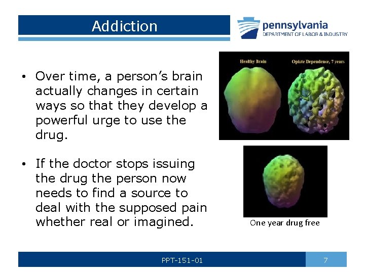 Addiction • Over time, a person’s brain actually changes in certain ways so that