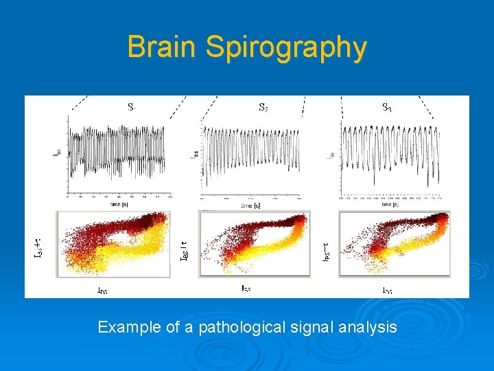 Brain Spirography Example of a pathological signal analysis 