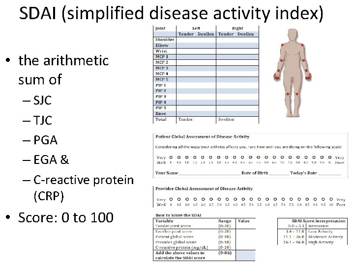 SDAI (simplified disease activity index) • the arithmetic sum of – SJC – TJC