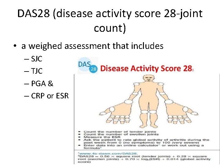 DAS 28 (disease activity score 28 -joint count) • a weighed assessment that includes