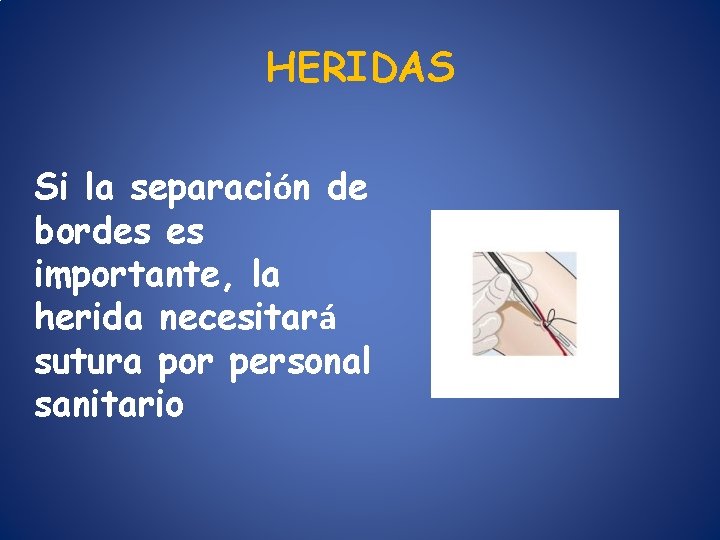HERIDAS Si la separación de bordes es importante, la herida necesitará sutura por personal