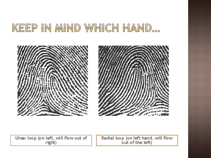 Ulnar loop (on left, will flow out of right) Radial loop (on left hand,