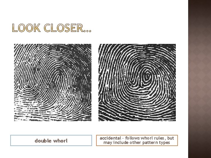 double whorl accidental – follows whorl rules, but may include other pattern types 