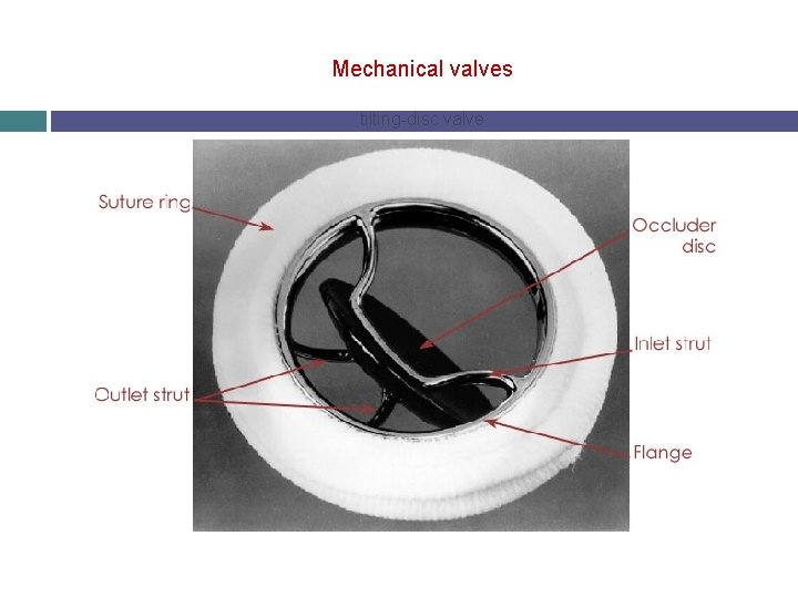 Mechanical valves tilting-disc valve 