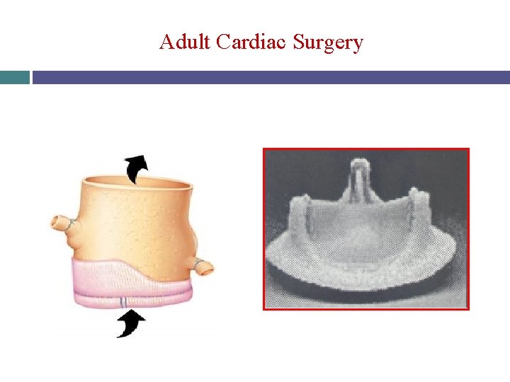 Adult Cardiac Surgery 