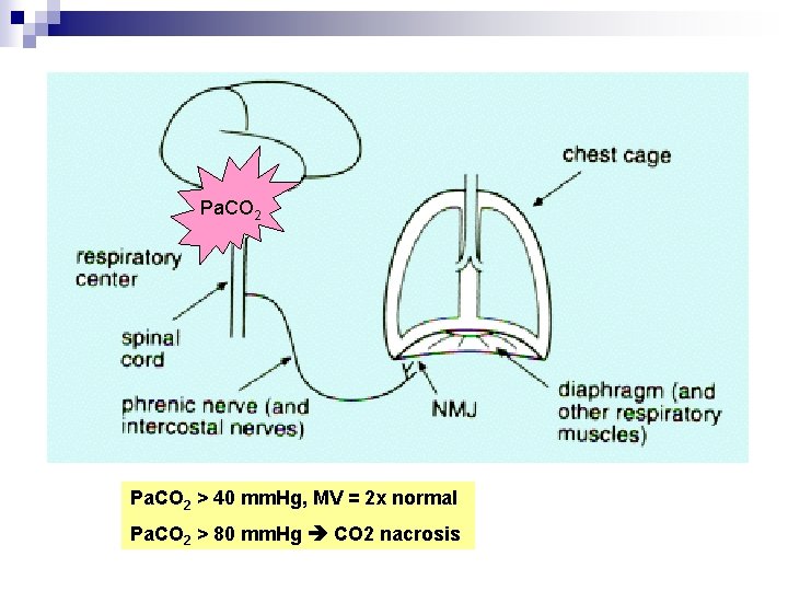 Pa. CO 2 > 40 mm. Hg, MV = 2 x normal Pa. CO