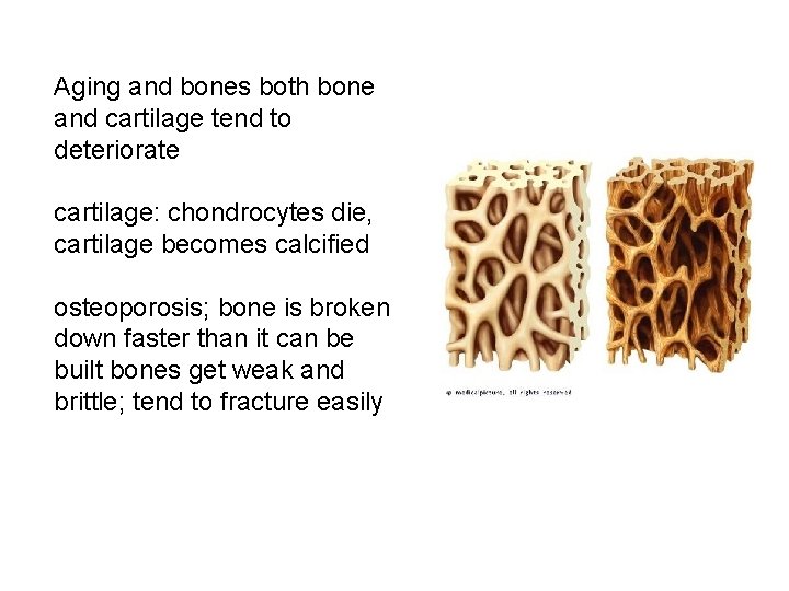 Aging and bones both bone and cartilage tend to deteriorate cartilage: chondrocytes die, cartilage