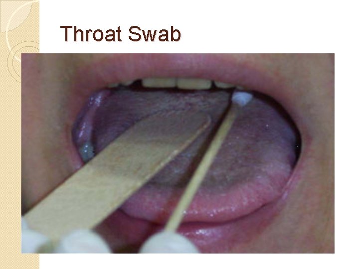Throat Swab 