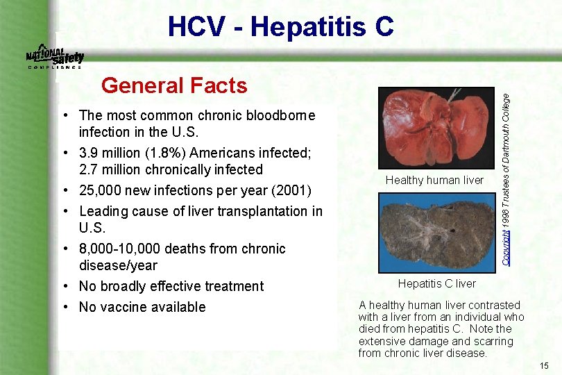 General Facts • The most common chronic bloodborne infection in the U. S. •