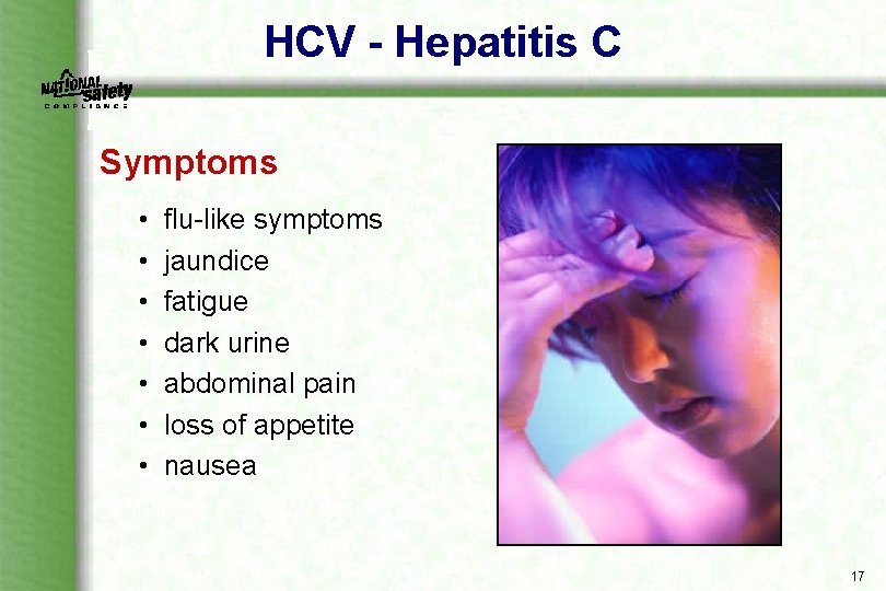 HCV - Hepatitis C Symptoms • • flu like symptoms jaundice fatigue dark urine