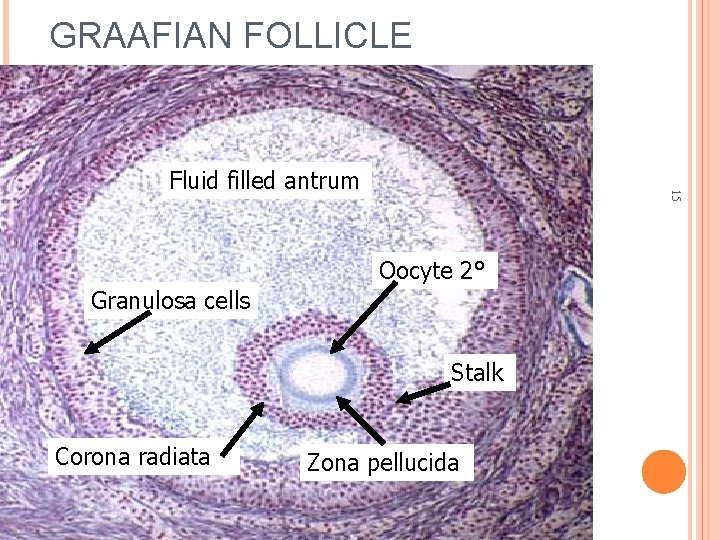 GRAAFIAN FOLLICLE 15 Fluid filled antrum Oocyte 2° Granulosa cells Stalk Corona radiata Zona