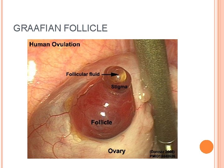 GRAAFIAN FOLLICLE 