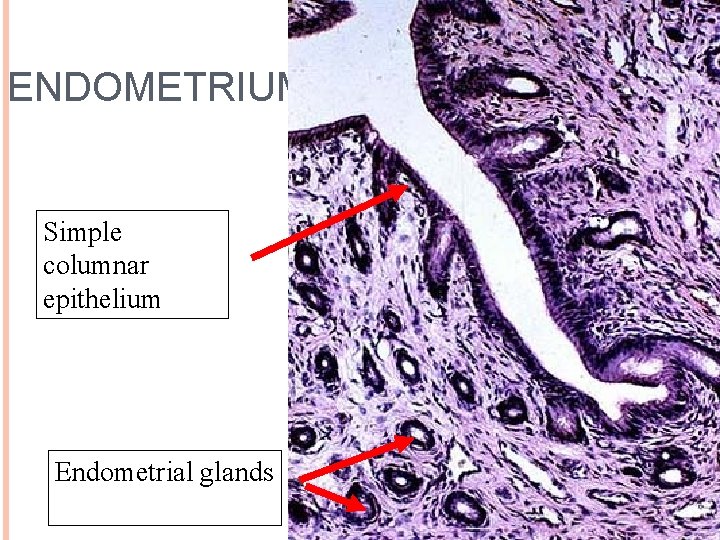 ENDOMETRIUM 30 Simple columnar epithelium Endometrial glands 