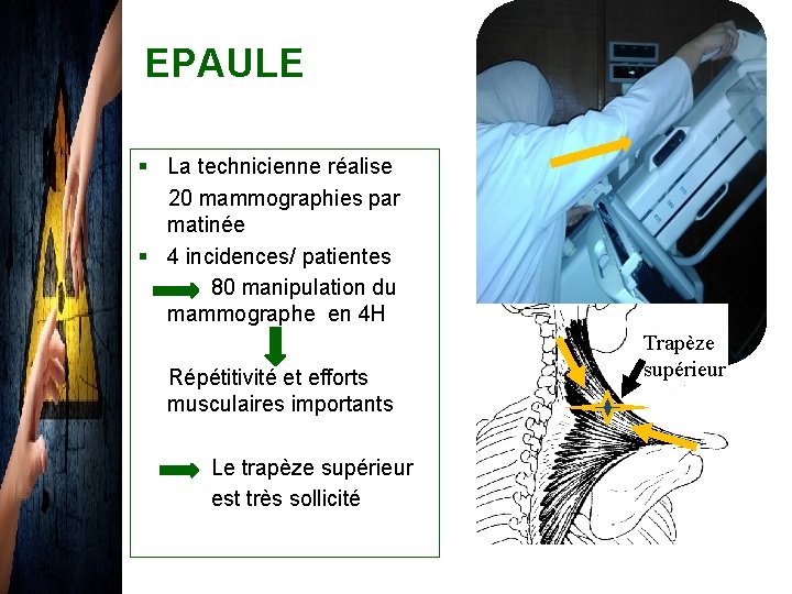 EPAULE § La technicienne réalise 20 mammographies par matinée § 4 incidences/ patientes 80