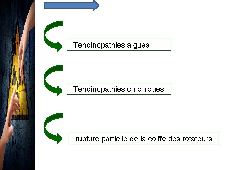 Tendinopathies aigues Tendinopathies chroniques rupture partielle de la coiffe des rotateurs 