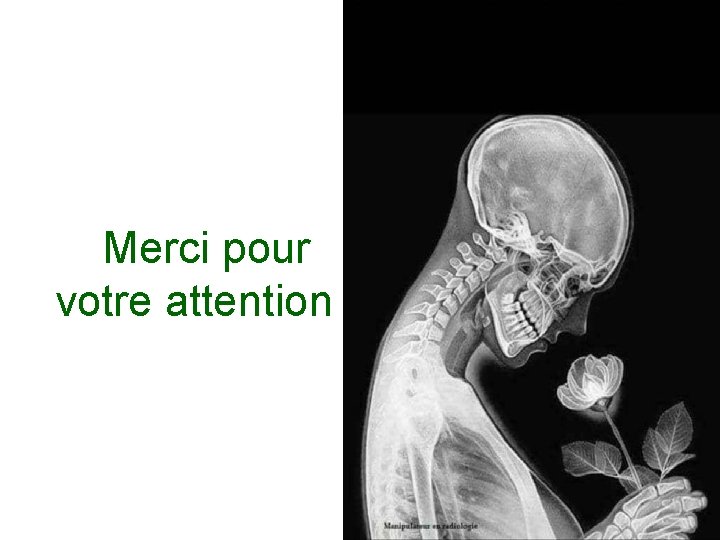  Merci pour votre attention 