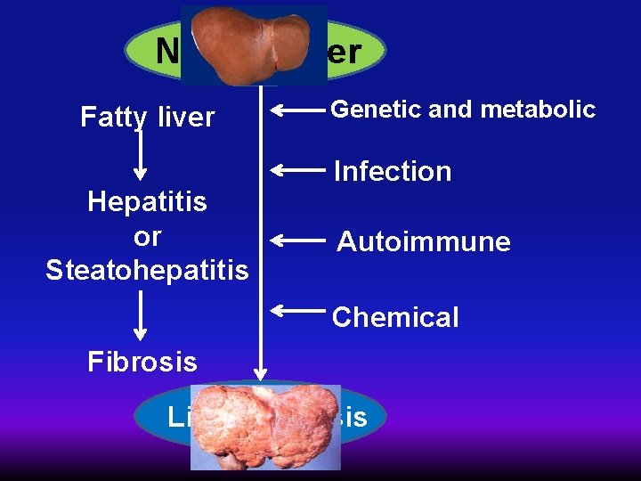Normal liver Fatty liver Hepatitis or Steatohepatitis Genetic and metabolic Infection Autoimmune Chemical Fibrosis