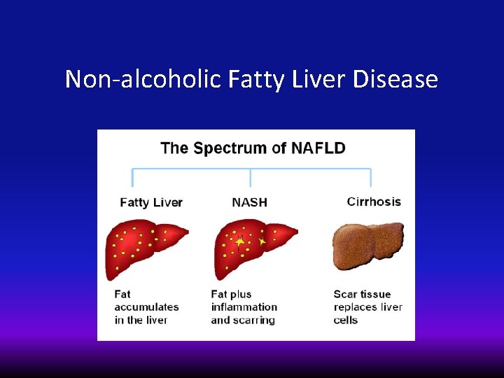 Non-alcoholic Fatty Liver Disease 