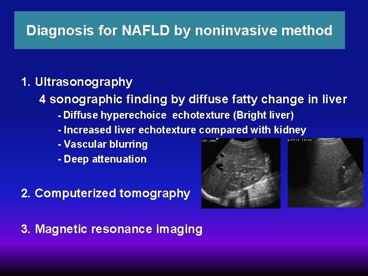 Diagnosis for NAFLD by noninvasive method 1. Ultrasonography 4 sonographic finding by diffuse fatty