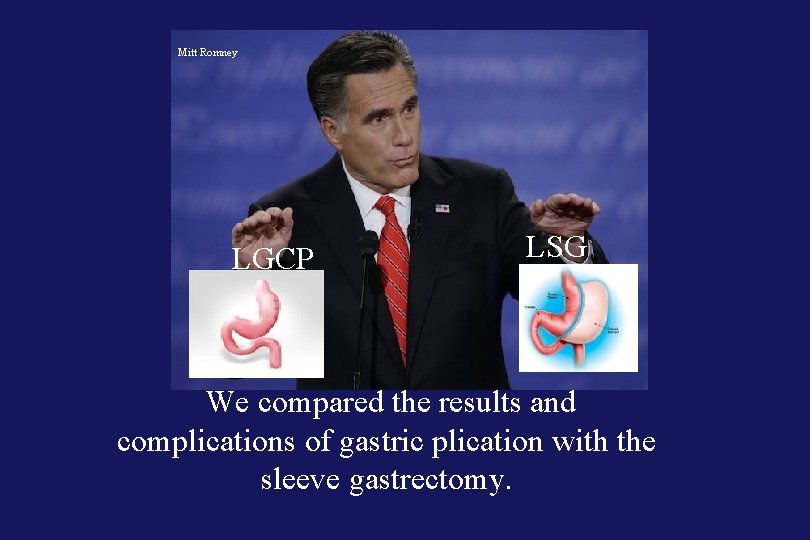 Mitt Romney LGCP LSG We compared the results and complications of gastric plication with