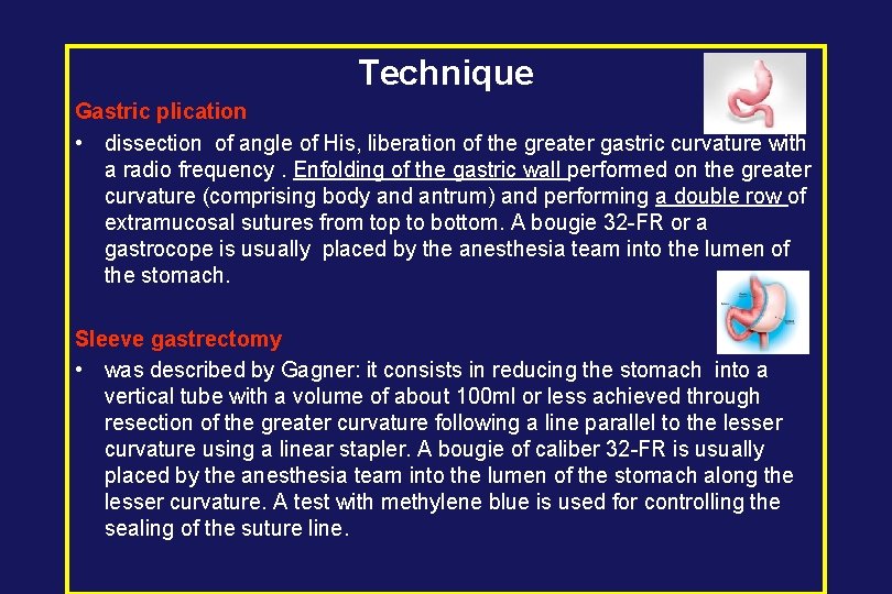 Technique Gastric plication • dissection of angle of His, liberation of the greater gastric