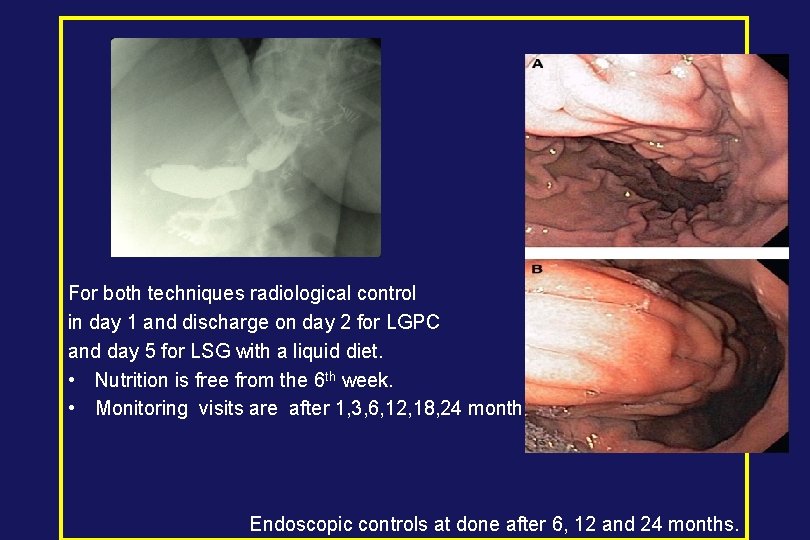  For both techniques radiological control in day 1 and discharge on day 2