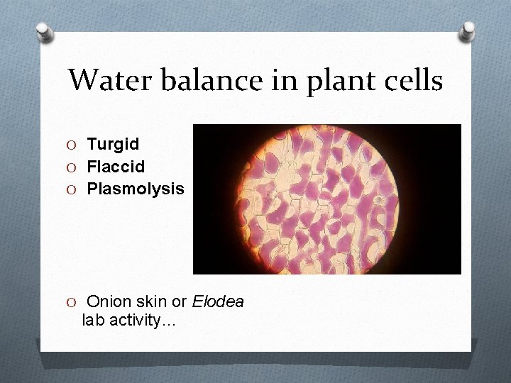 Water balance in plant cells O Turgid O Flaccid O Plasmolysis O Onion skin