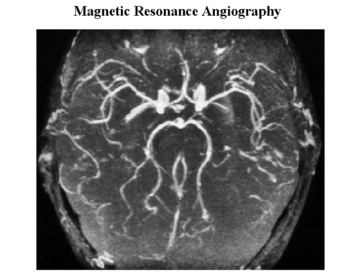 Magnetic Resonance Angiography 