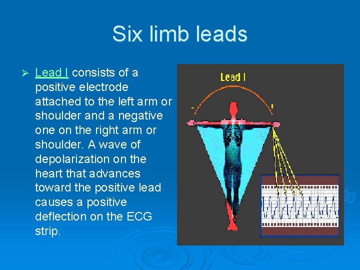 Six limb leads Ø Lead I consists of a positive electrode attached to the