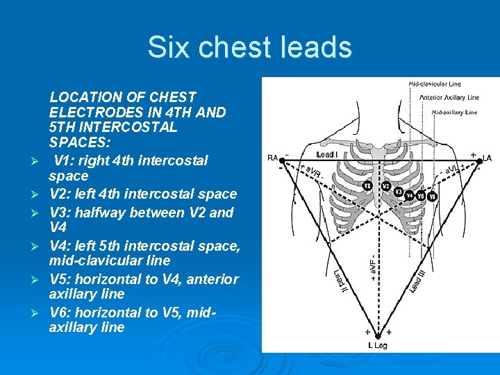 Six chest leads LOCATION OF CHEST ELECTRODES IN 4 TH AND 5 TH INTERCOSTAL