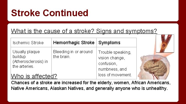 Stroke Continued What is the cause of a stroke? Signs and symptoms? Ischemic Stroke