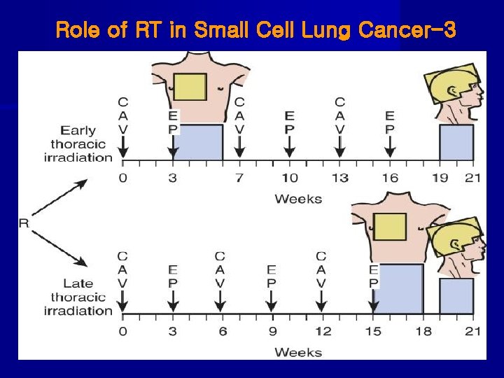 Role of RT in Small Cell Lung Cancer-3 