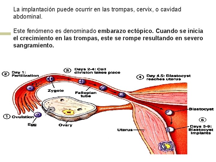 La implantación puede ocurrir en las trompas, cervix, o cavidad abdominal. Este fenómeno es
