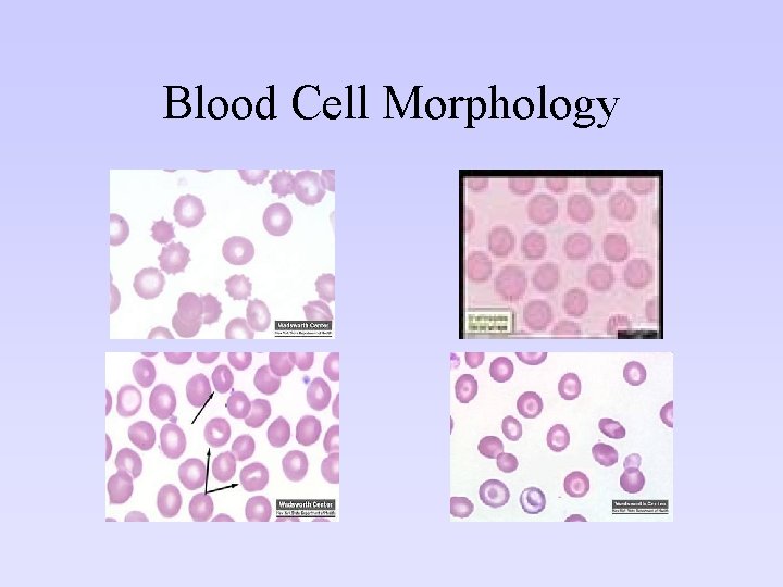 Blood Cell Morphology 