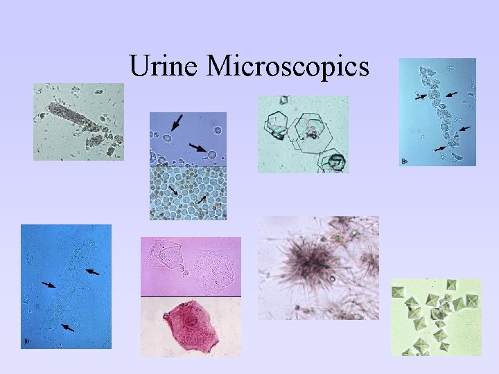 Urine Microscopics 