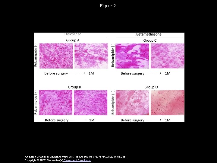 Figure 2 American Journal of Ophthalmology 2017 18126 -36 DOI: (10. 1016/j. ajo. 2017.