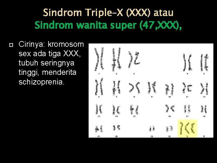 Sindrom Triple–X (XXX) atau Sindrom wanita super (47, XXX), Cirinya: kromosom sex ada tiga