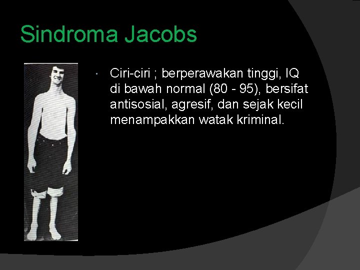 Sindroma Jacobs Ciri-ciri ; berperawakan tinggi, IQ di bawah normal (80 - 95), bersifat