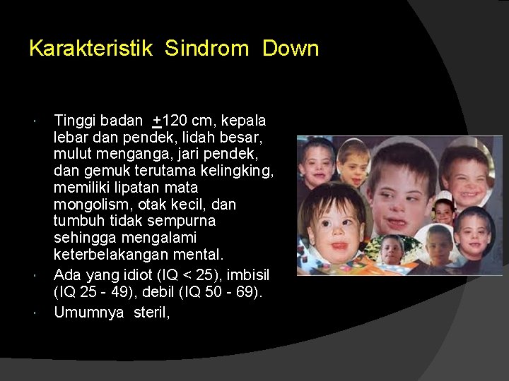 Karakteristik Sindrom Down Tinggi badan +120 cm, kepala lebar dan pendek, lidah besar, mulut