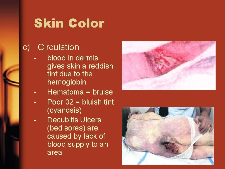 Skin Color c) Circulation - - blood in dermis gives skin a reddish tint