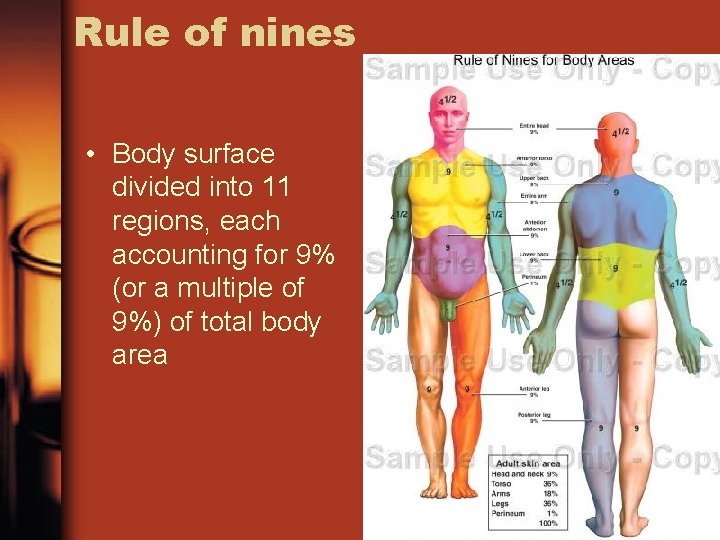 Rule of nines • Body surface divided into 11 regions, each accounting for 9%