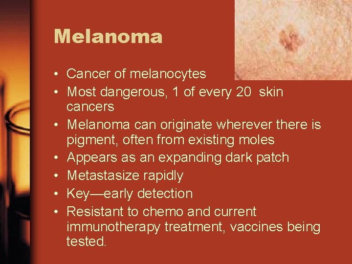 Melanoma • Cancer of melanocytes • Most dangerous, 1 of every 20 skin cancers